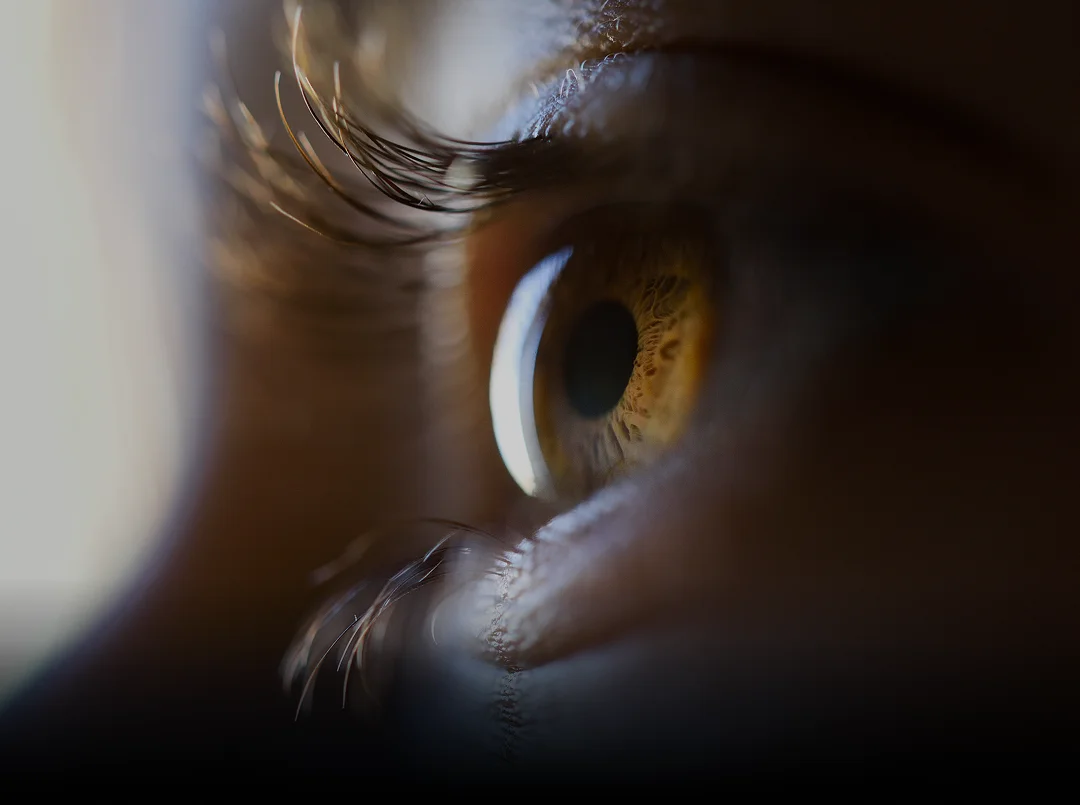 Visão Monocular e BPC: Como Demonstrar as Barreiras para Garantir o Direito ao Benefício Assistencial